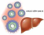 Người viêm gan B dễ bị ung thư gan